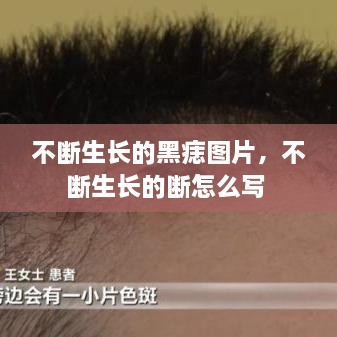 不斷生長(cháng)的黑痣圖片，不斷生長(cháng)的斷怎么寫(xiě) 
