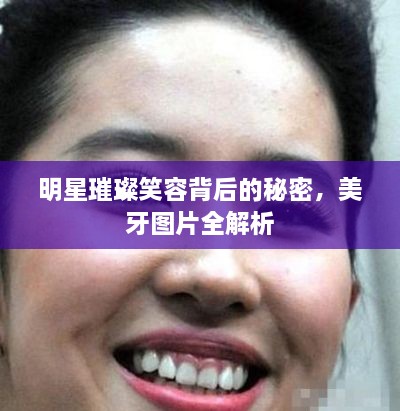 明星璀璨笑容背后的秘密，美牙圖片全解析