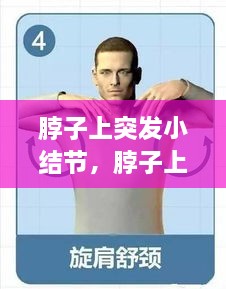 脖子上突發(fā)小結節，脖子上的小結節要緊嗎 