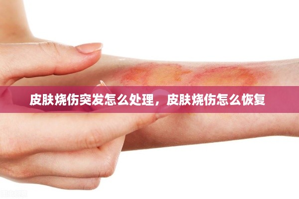 皮膚燒傷突發(fā)怎么處理，皮膚燒傷怎么恢復 