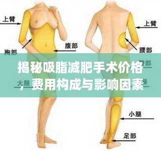揭秘吸脂減肥手術(shù)價(jià)格，費用構成與影響因素全解析